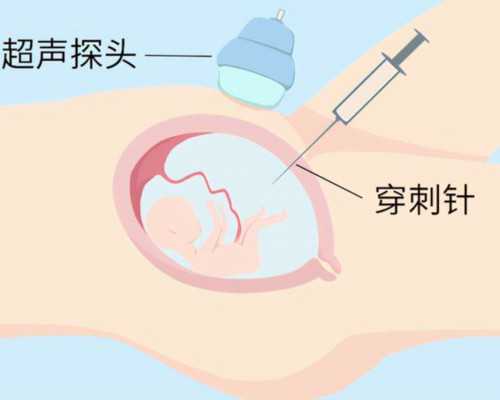 高龄供卵价格-杭州沒子宫代孕生小孩