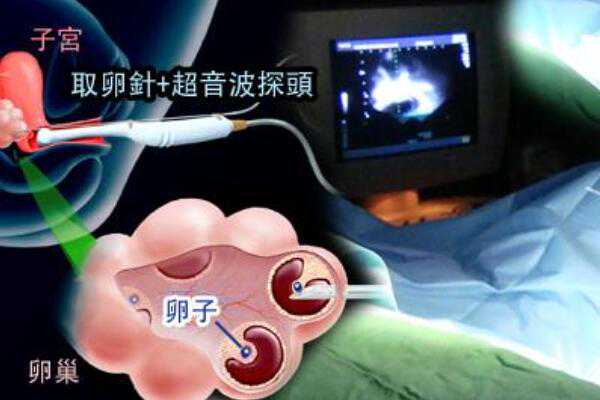 杭州有没人愿意代孕的|永州三代试管多少钱一次_正规医院三代试管多少钱