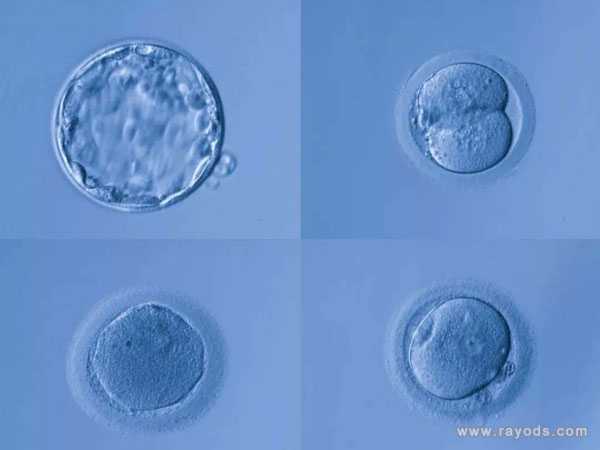 长寿代母移植成功率_试管胚胎移植后玉米能吃吗？孕妇吃玉米有哪些好处